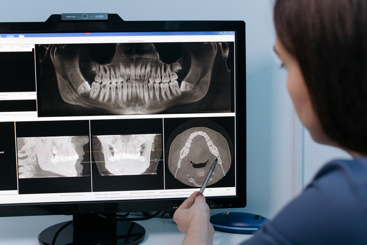 The Science And Success Of Invisalign