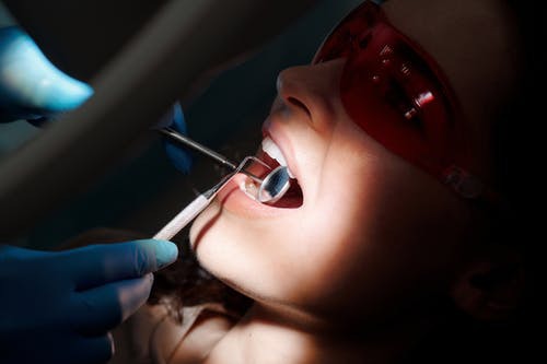 How Do You Maintain Your Smile After Teeth Whitening?